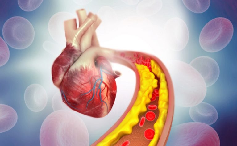 The Surprising Connection Between Cholesterol and Electricity—and What It Means for Facilities